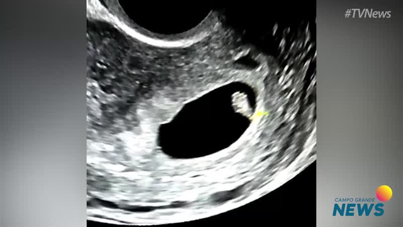 Sem qualquer tratamento, casal engravida naturalmente de trig&ecirc;meas